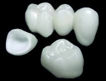 tooth bridge and crown